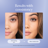 Age Renewal Day Cream 