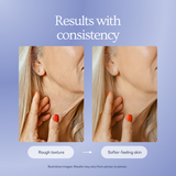 Age Renewal Night Cream